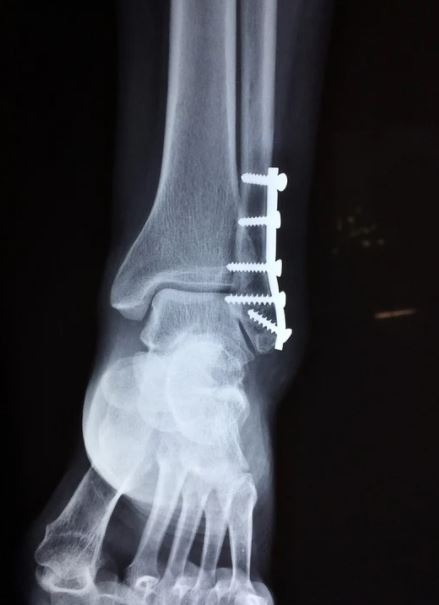 Don't overburden your feet