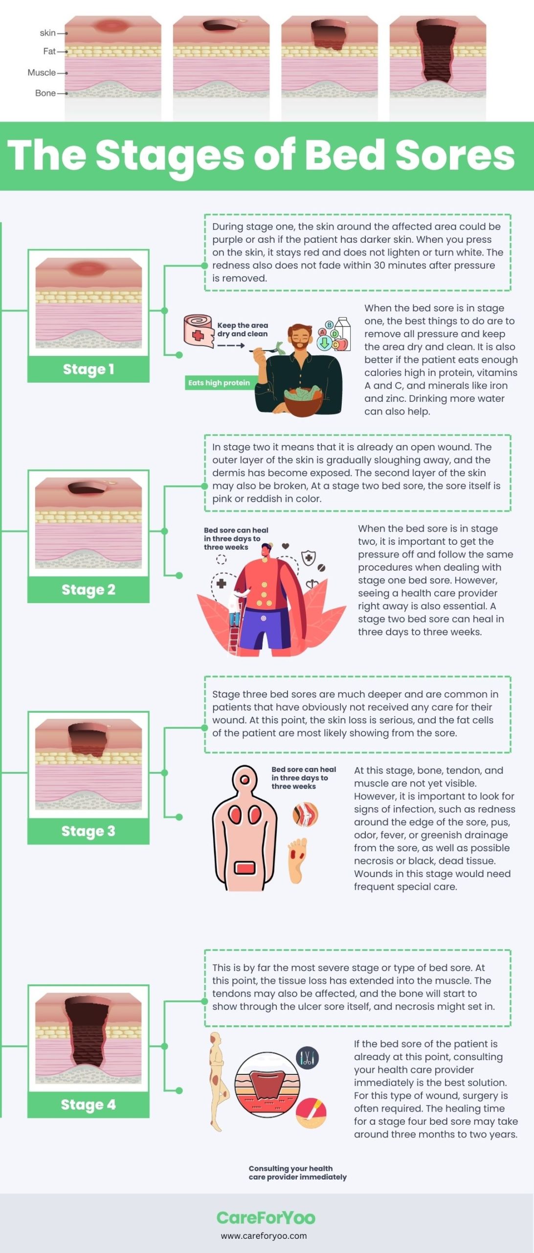 the different stages of bed sores